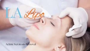 Woman receiving Actinic Keratosis Removal Treatment West Dulwich