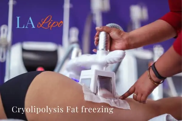 women getting fat freezing West Dulwich