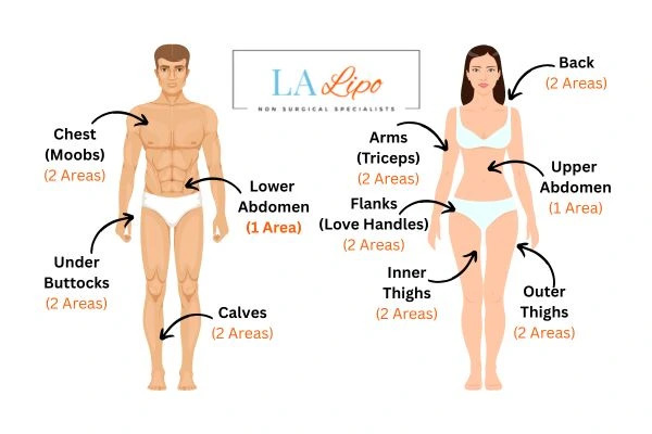 LA LIPO Cryolipolysis Areas West Dulwich