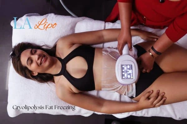 woman getting cryolipolysis West Dulwich