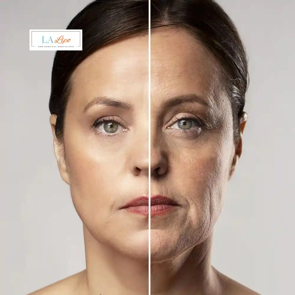 How Can You Tell If Non-Surgical Skin Tightening Is Right for You West Dulwich?